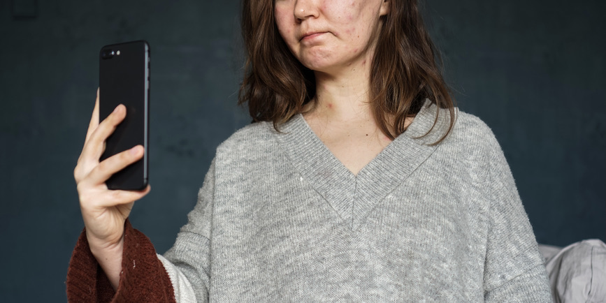 Crusty Blusters How to get rid of impetigo fast! - Dr. B